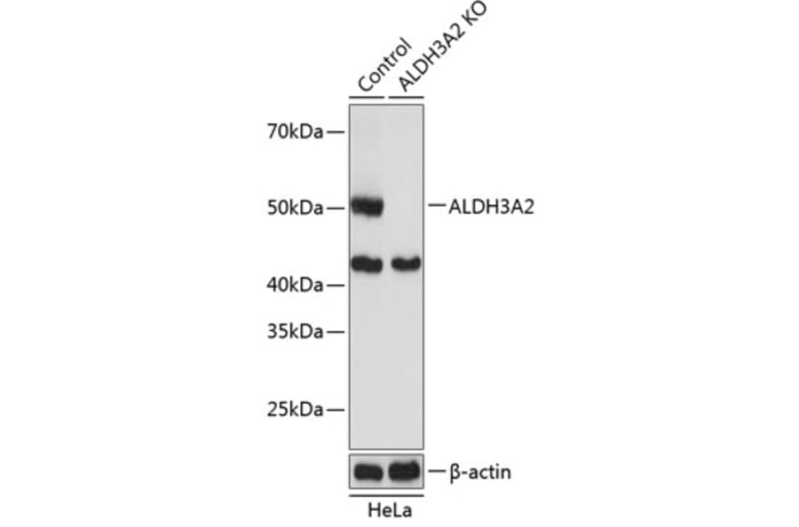 Western Blot - Anti-Aldehyde dehydrogenase 10 Antibody (A305676) - Antibodies.com