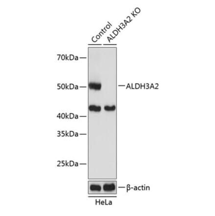 Western Blot - Anti-Aldehyde dehydrogenase 10 Antibody (A305676) - Antibodies.com