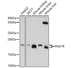 Western Blot - Anti-Mrpl18 Antibody (A305677) - Antibodies.com