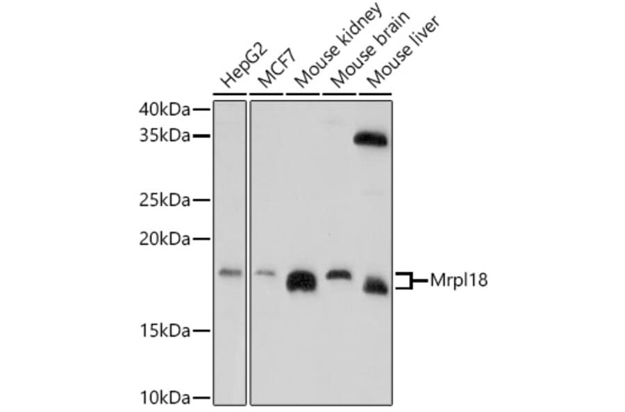 Western Blot - Anti-Mrpl18 Antibody (A305677) - Antibodies.com
