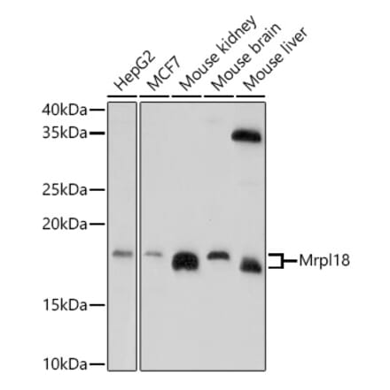 Western Blot - Anti-Mrpl18 Antibody (A305677) - Antibodies.com