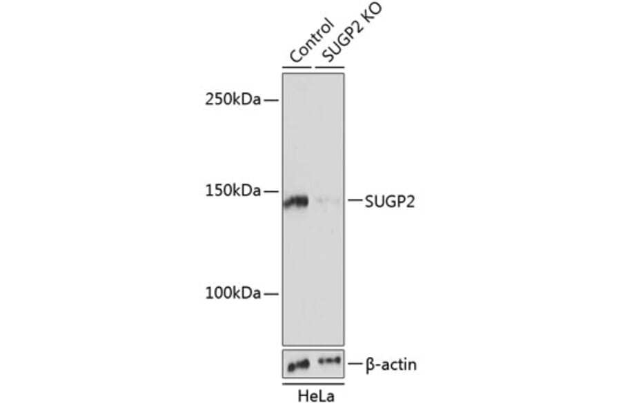 Western Blot - Anti-SFRS14/SUGP2 Antibody (A305678) - Antibodies.com