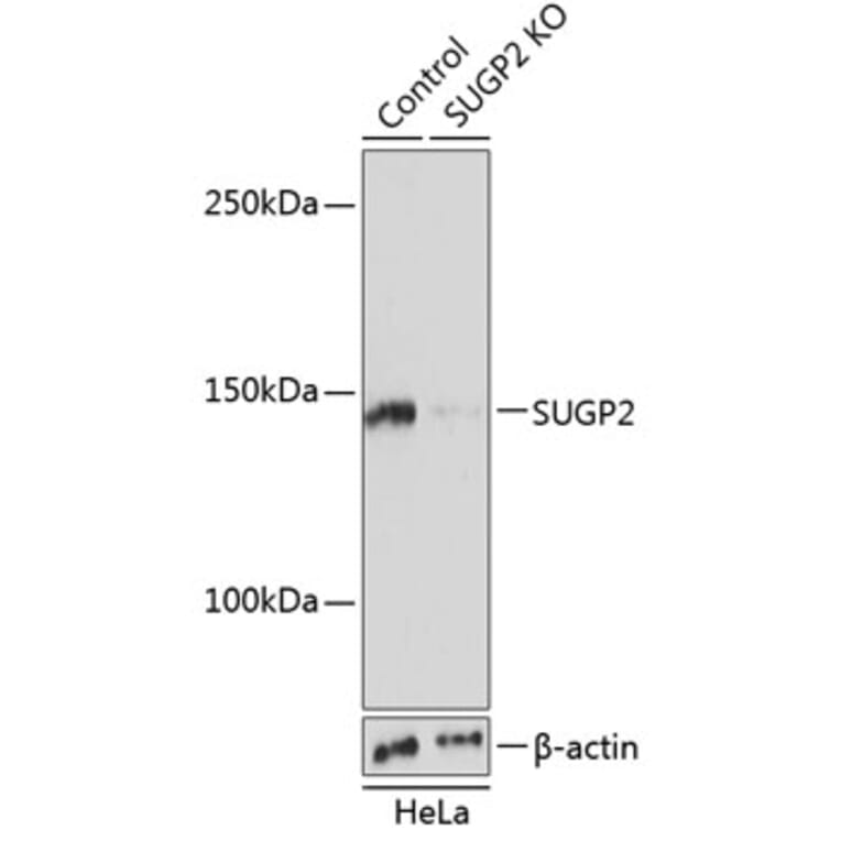 Western Blot - Anti-SFRS14/SUGP2 Antibody (A305678) - Antibodies.com