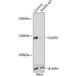 Western Blot - Anti-SFRS14/SUGP2 Antibody (A305678) - Antibodies.com