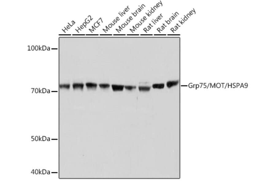 Western Blot - Anti-Grp75/MOT Antibody [ARC0566] (A305679) - Antibodies.com