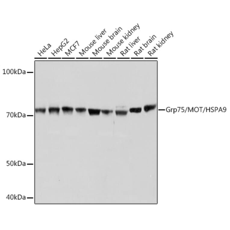 Western Blot - Anti-Grp75/MOT Antibody [ARC0566] (A305679) - Antibodies.com