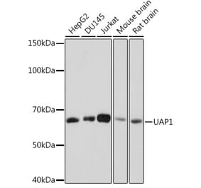 Western Blot - Anti-UAP1 Antibody [ARC1769] (A305680) - Antibodies.com