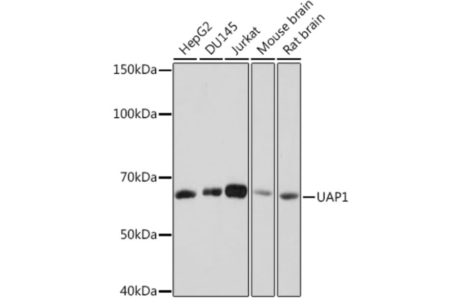 Western Blot - Anti-UAP1 Antibody [ARC1769] (A305680) - Antibodies.com