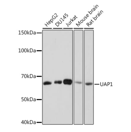 Western Blot - Anti-UAP1 Antibody [ARC1769] (A305680) - Antibodies.com