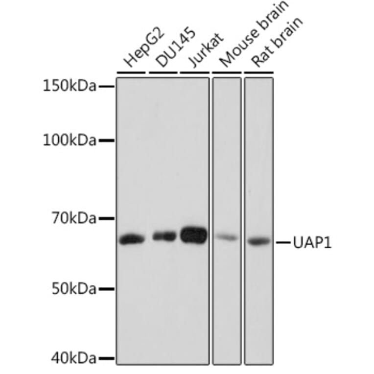 Western Blot - Anti-UAP1 Antibody [ARC1769] (A305680) - Antibodies.com