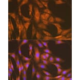 Immunofluorescence - Anti-UAP1 Antibody [ARC1769] (A305680) - Antibodies.com