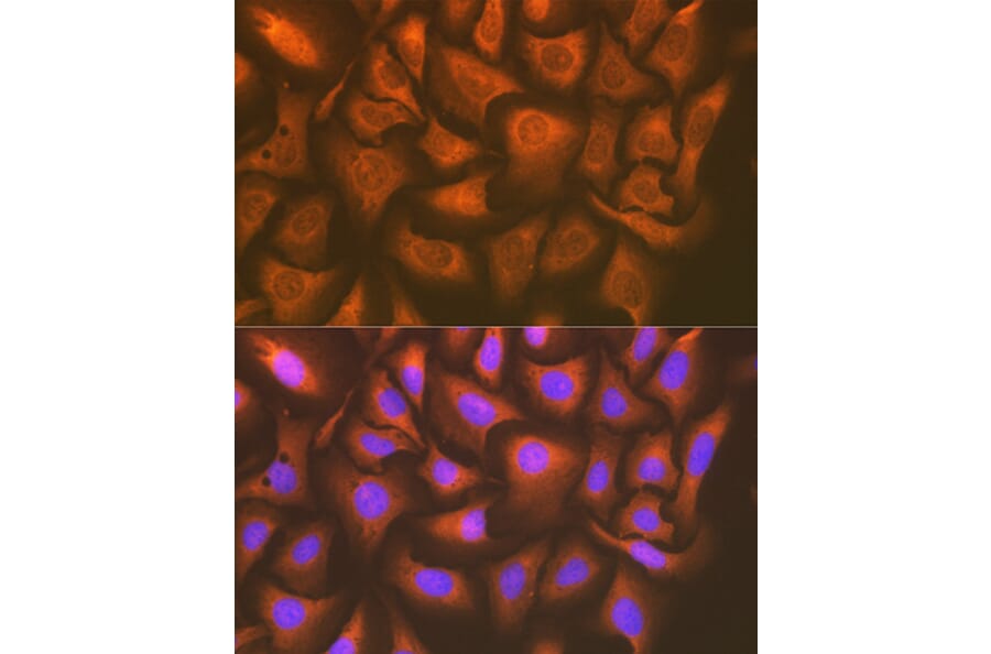 Immunofluorescence - Anti-UAP1 Antibody [ARC1769] (A305680) - Antibodies.com