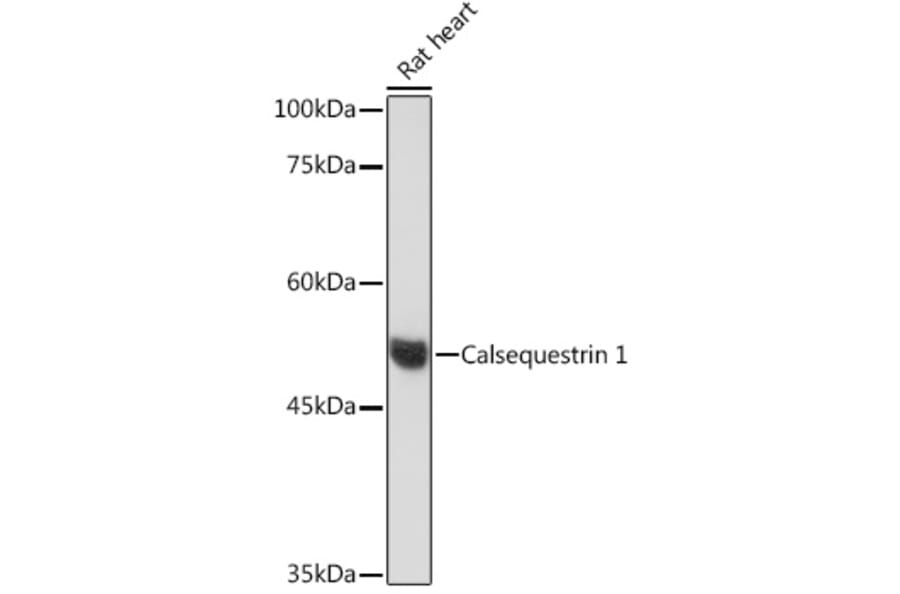 Western Blot - Anti-Calsequestrin 1 Antibody [ARC2209] (A305681) - Antibodies.com
