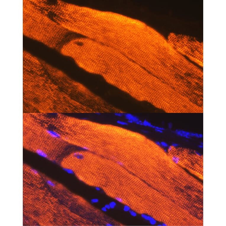 Immunofluorescence - Anti-Calsequestrin 1 Antibody [ARC2209] (A305681) - Antibodies.com