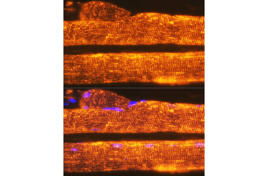 Immunofluorescence - Anti-Calsequestrin 1 Antibody [ARC2209] (A305681) - Antibodies.com