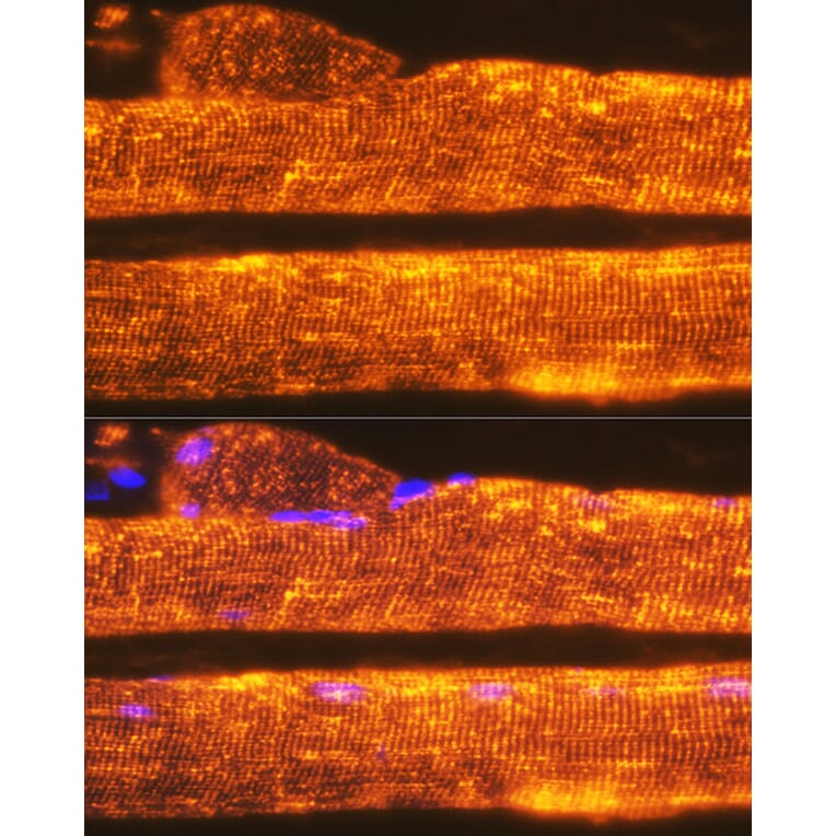 Immunofluorescence - Anti-Calsequestrin 1 Antibody [ARC2209] (A305681) - Antibodies.com