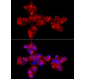 Immunofluorescence - Anti-alpha 1 Antitrypsin Antibody [ARC54184] (A305682) - Antibodies.com