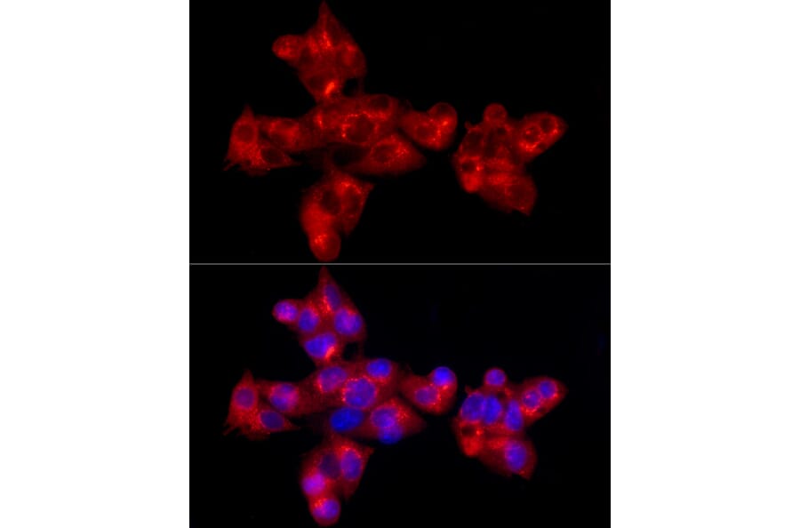 Immunofluorescence - Anti-alpha 1 Antitrypsin Antibody [ARC54184] (A305682) - Antibodies.com
