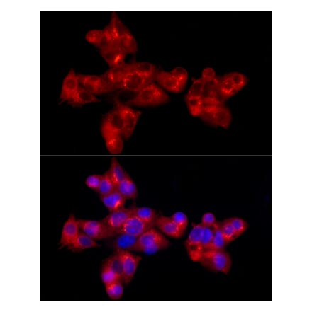 Immunofluorescence - Anti-alpha 1 Antitrypsin Antibody [ARC54184] (A305682) - Antibodies.com