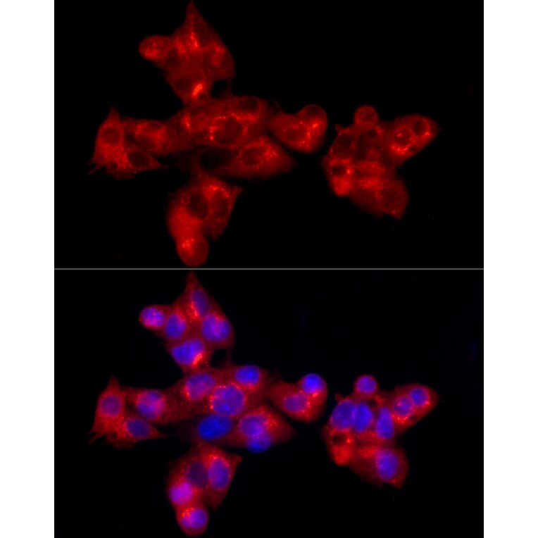 Immunofluorescence - Anti-alpha 1 Antitrypsin Antibody [ARC54184] (A305682) - Antibodies.com