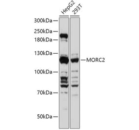 Western Blot - Anti-ZCWCC1 Antibody (A305685) - Antibodies.com