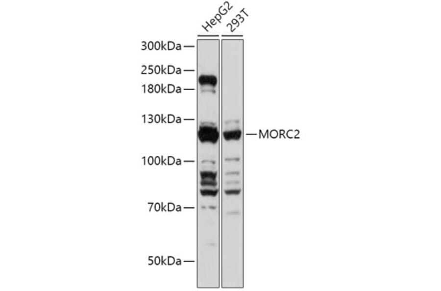 Western Blot - Anti-ZCWCC1 Antibody (A305685) - Antibodies.com