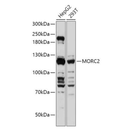 Western Blot - Anti-ZCWCC1 Antibody (A305685) - Antibodies.com