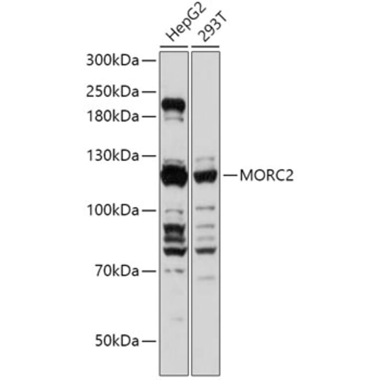 Western Blot - Anti-ZCWCC1 Antibody (A305685) - Antibodies.com
