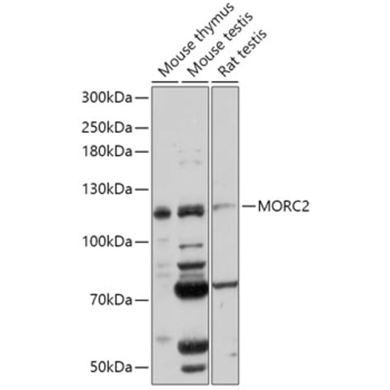 Western Blot - Anti-ZCWCC1 Antibody (A305685) - Antibodies.com