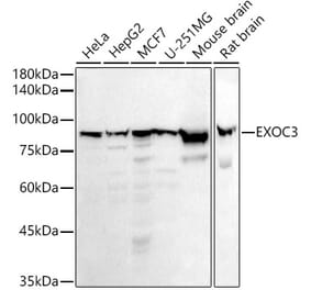 Western Blot - Anti-rSec6 Antibody [ARC2900] (A305686) - Antibodies.com