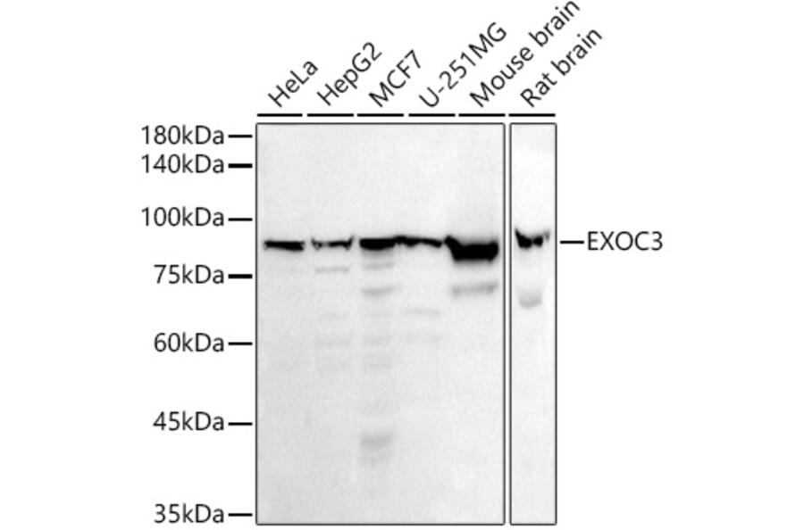 Western Blot - Anti-rSec6 Antibody [ARC2900] (A305686) - Antibodies.com