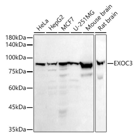 Western Blot - Anti-rSec6 Antibody [ARC2900] (A305686) - Antibodies.com