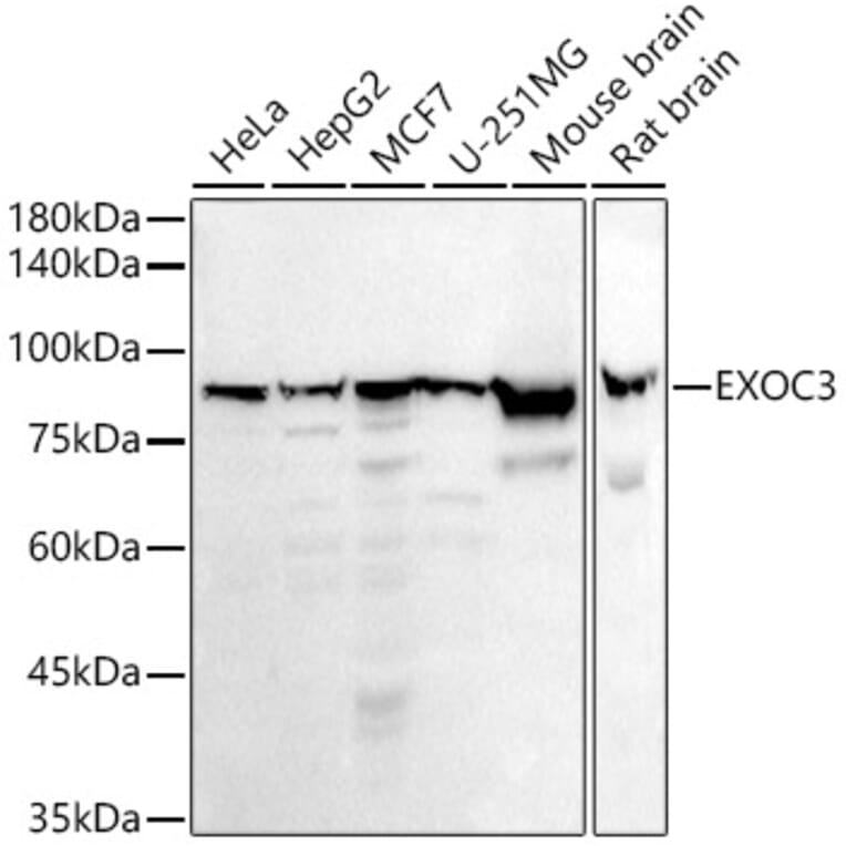 Western Blot - Anti-rSec6 Antibody [ARC2900] (A305686) - Antibodies.com