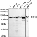 Western Blot - Anti-rSec6 Antibody [ARC2900] (A305686) - Antibodies.com