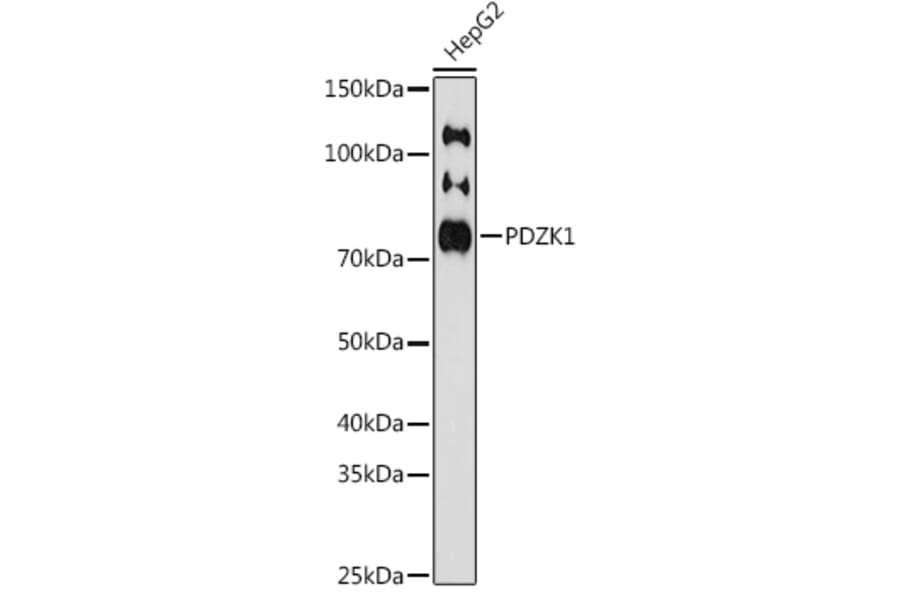 Western Blot - Anti-PDZK1 Antibody [ARC1334] (A305687) - Antibodies.com