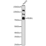 Western Blot - Anti-PDZK1 Antibody [ARC1334] (A305687) - Antibodies.com
