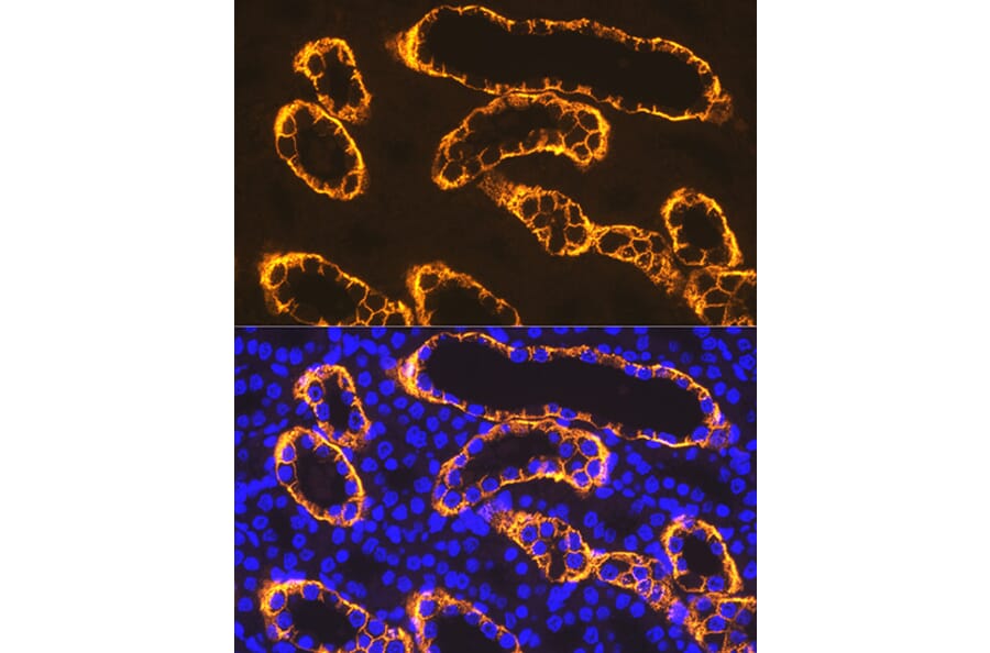 Immunofluorescence - Anti-PDZK1 Antibody [ARC1334] (A305687) - Antibodies.com