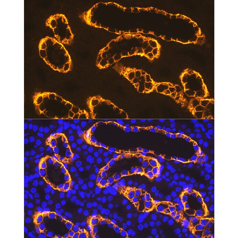 Immunofluorescence - Anti-PDZK1 Antibody [ARC1334] (A305687) - Antibodies.com