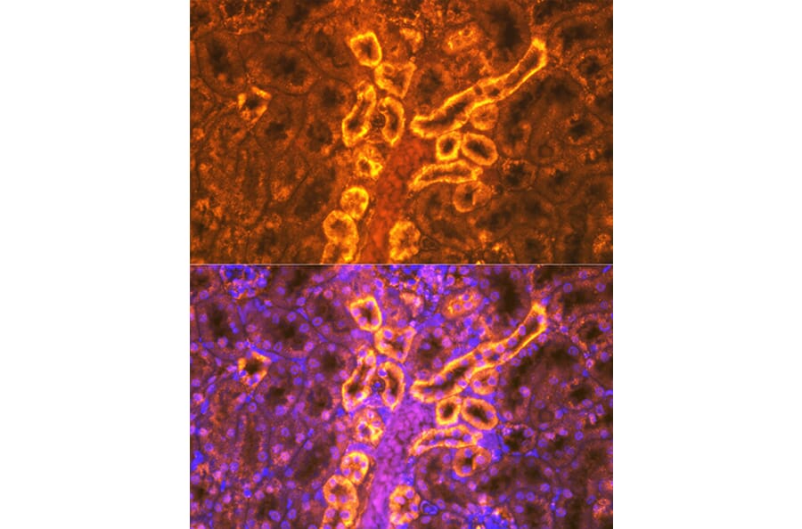 Immunofluorescence - Anti-PDZK1 Antibody [ARC1334] (A305687) - Antibodies.com