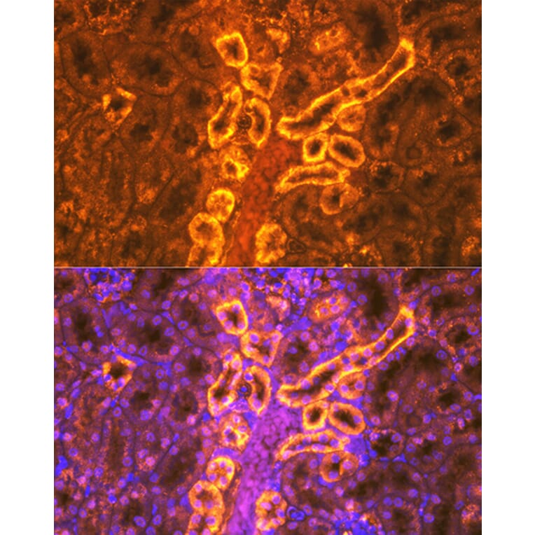 Immunofluorescence - Anti-PDZK1 Antibody [ARC1334] (A305687) - Antibodies.com