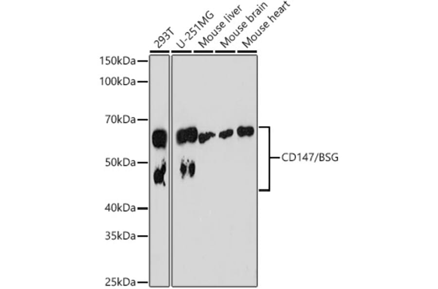 Western Blot - Anti-CD147 Antibody [ARC0964] (A305688) - Antibodies.com