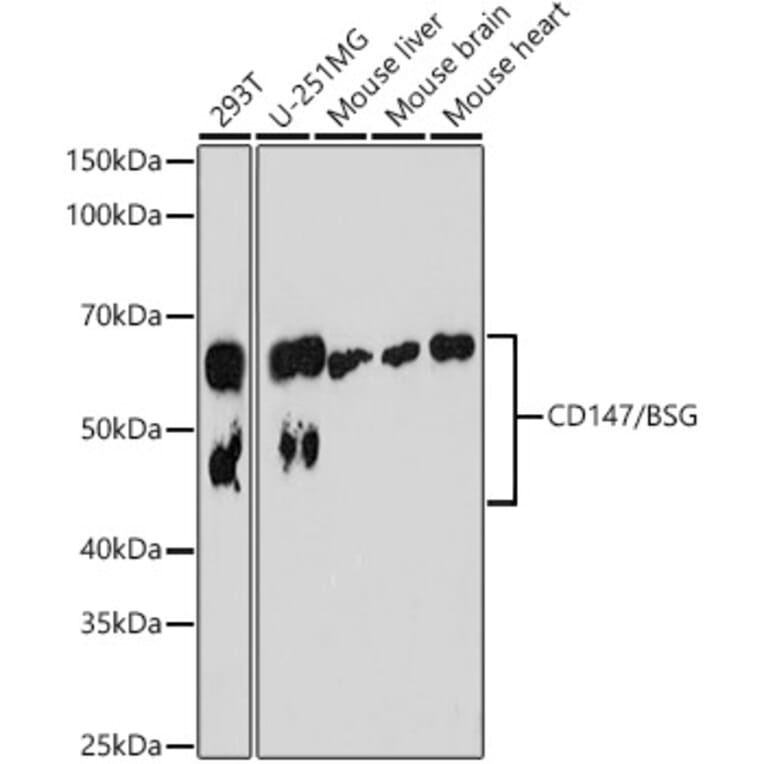 Western Blot - Anti-CD147 Antibody [ARC0964] (A305688) - Antibodies.com