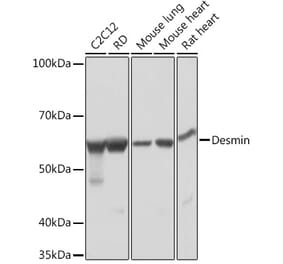 Western Blot - Anti-Desmin Antibody [ARC0235] (A305689) - Antibodies.com