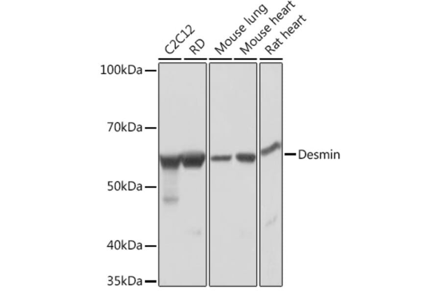 Western Blot - Anti-Desmin Antibody [ARC0235] (A305689) - Antibodies.com