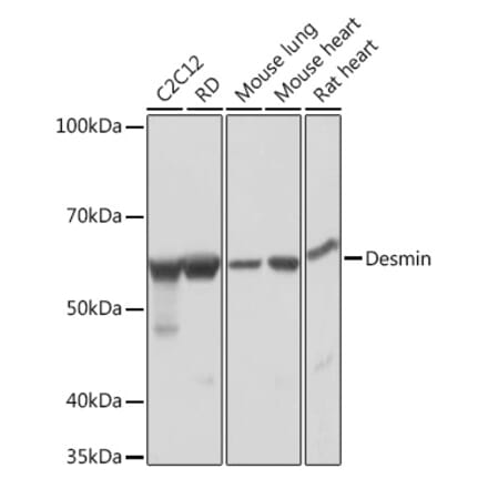 Western Blot - Anti-Desmin Antibody [ARC0235] (A305689) - Antibodies.com