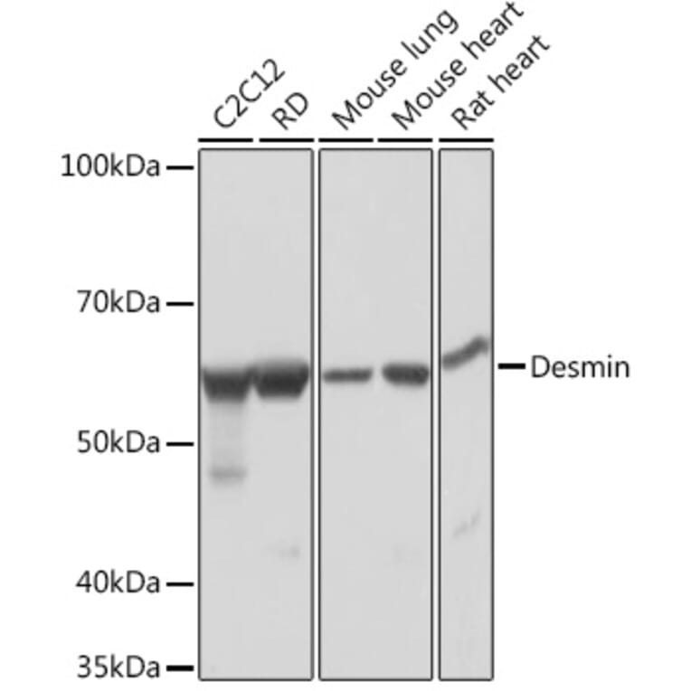 Western Blot - Anti-Desmin Antibody [ARC0235] (A305689) - Antibodies.com
