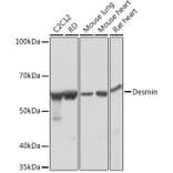 Western Blot - Anti-Desmin Antibody [ARC0235] (A305689) - Antibodies.com