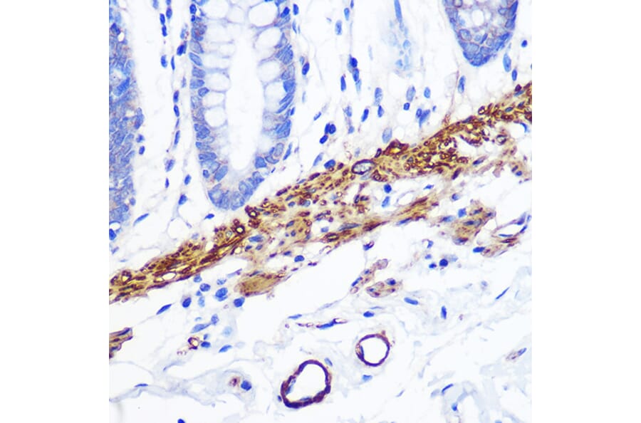 Immunohistochemistry - Anti-Desmin Antibody [ARC0235] (A305689) - Antibodies.com