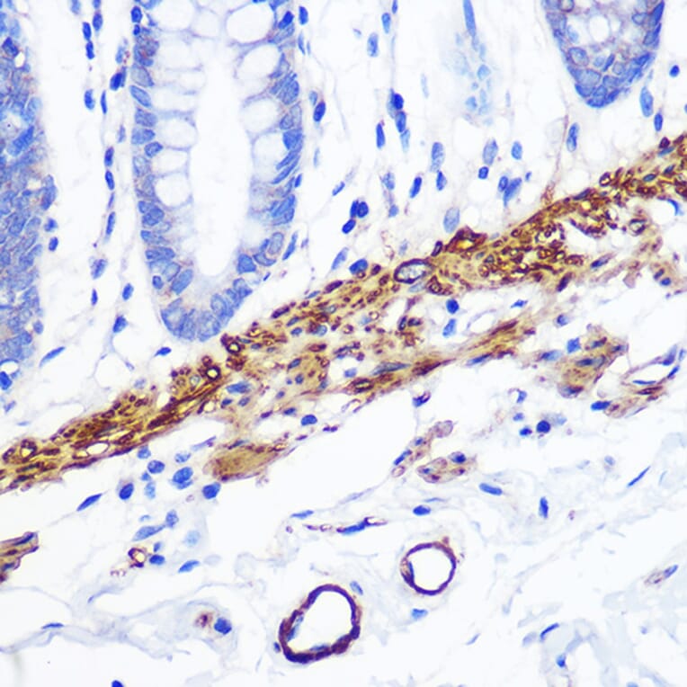 Immunohistochemistry - Anti-Desmin Antibody [ARC0235] (A305689) - Antibodies.com
