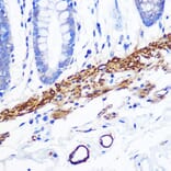 Immunohistochemistry - Anti-Desmin Antibody [ARC0235] (A305689) - Antibodies.com